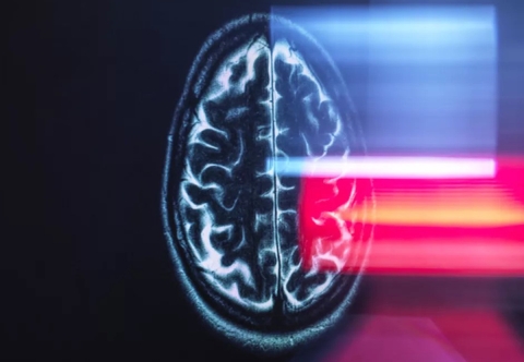 Trí tuệ nhân tạo (AI) mang lại bước đột phá trong chẩn đoán bệnh Alzheimer sớm